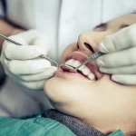 swelling after dental surgery